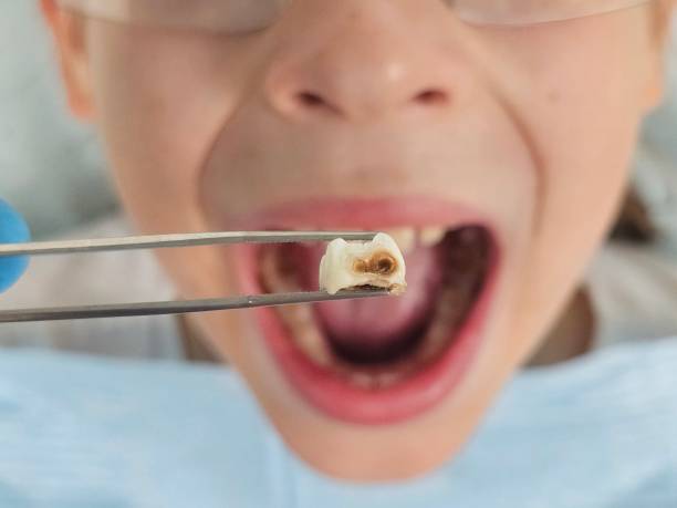 Best Emergency Treatment for Oral Infections in Waupun, WI
